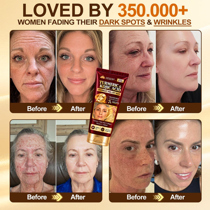 𝑶𝒇𝒇𝒊𝒄𝒊𝒂𝒍 𝑺𝒕𝒐𝒓𝒆 | 𝐍𝐞𝐰! ✨ 𝐇𝐢𝐬𝐤𝐢𝐧® 𝐓𝐮𝐫𝐦𝐞𝐫𝐢𝐜 × 𝐊𝐨𝐣𝐢𝐜 𝐀𝐜𝐢𝐝 𝐎𝐯𝐞𝐫𝐧𝐢𝐠𝐡𝐭 𝐏𝐞𝐞𝐥-𝐎𝐟𝐟 𝐌𝐚𝐬𝐤 — 𝐅𝐚𝐝𝐞 𝐒𝐭𝐮𝐛𝐛𝐨𝐫𝐧 𝐃𝐚𝐫𝐤 𝐒𝐩𝐨𝐭𝐬 & 𝐒𝐦𝐨𝐨𝐭𝐡 𝐕𝐢𝐬𝐢𝐛𝐥𝐞 𝐖𝐫𝐢𝐧𝐤𝐥𝐞𝐬 𝐖𝐡𝐢𝐥𝐞 𝐘𝐨𝐮 𝐒𝐥𝐞𝐞𝐩 🌙✨ 𝐓𝐮𝐫𝐦𝐞𝐫𝐢𝐜 × 𝐊𝐨𝐣𝐢𝐜 𝐀𝐜𝐢𝐝 × 𝐏𝐞𝐩𝐭𝐢𝐝𝐞𝐬 ✅ 𝐎𝐧𝐞 𝐒𝐭𝐞𝐩 𝐚 𝐍𝐢𝐠𝐡𝐭 · 𝐕𝐢𝐬𝐢𝐛𝐥𝐞 𝐂𝐡𝐚𝐧𝐠𝐞𝐬 𝐢𝐧 𝟕 𝐍𝐢𝐠𝐡𝐭𝐬 💯