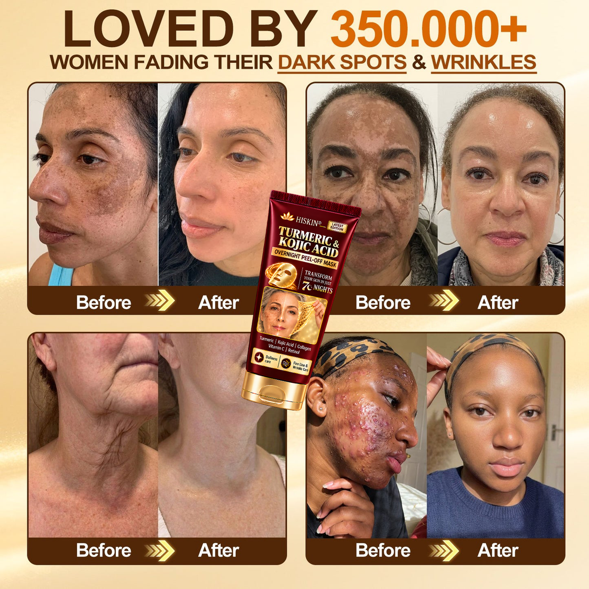 𝑶𝒇𝒇𝒊𝒄𝒊𝒂𝒍 𝑺𝒕𝒐𝒓𝒆 | 𝐍𝐞𝐰! ✨ 𝐇𝐢𝐬𝐤𝐢𝐧® 𝐓𝐮𝐫𝐦𝐞𝐫𝐢𝐜 × 𝐊𝐨𝐣𝐢𝐜 𝐀𝐜𝐢𝐝 𝐎𝐯𝐞𝐫𝐧𝐢𝐠𝐡𝐭 𝐏𝐞𝐞𝐥-𝐎𝐟𝐟 𝐌𝐚𝐬𝐤 — 𝐅𝐚𝐝𝐞 𝐒𝐭𝐮𝐛𝐛𝐨𝐫𝐧 𝐃𝐚𝐫𝐤 𝐒𝐩𝐨𝐭𝐬 & 𝐒𝐦𝐨𝐨𝐭𝐡 𝐕𝐢𝐬𝐢𝐛𝐥𝐞 𝐖𝐫𝐢𝐧𝐤𝐥𝐞𝐬 𝐖𝐡𝐢𝐥𝐞 𝐘𝐨𝐮 𝐒𝐥𝐞𝐞𝐩 🌙✨ 𝐓𝐮𝐫𝐦𝐞𝐫𝐢𝐜 × 𝐊𝐨𝐣𝐢𝐜 𝐀𝐜𝐢𝐝 × 𝐏𝐞𝐩𝐭𝐢𝐝𝐞𝐬 ✅ 𝐎𝐧𝐞 𝐒𝐭𝐞𝐩 𝐚 𝐍𝐢𝐠𝐡𝐭 · 𝐕𝐢𝐬𝐢𝐛𝐥𝐞 𝐂𝐡𝐚𝐧𝐠𝐞𝐬 𝐢𝐧 𝟕 𝐍𝐢𝐠𝐡𝐭𝐬 💯