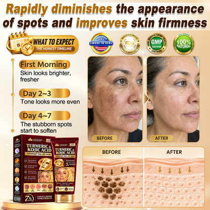 𝑶𝒇𝒇𝒊𝒄𝒊𝒂𝒍 𝑺𝒕𝒐𝒓𝒆 | 𝐍𝐞𝐰! ✨ 𝐇𝐢𝐬𝐤𝐢𝐧® 𝐓𝐮𝐫𝐦𝐞𝐫𝐢𝐜 × 𝐊𝐨𝐣𝐢𝐜 𝐀𝐜𝐢𝐝 𝐎𝐯𝐞𝐫𝐧𝐢𝐠𝐡𝐭 𝐏𝐞𝐞𝐥-𝐎𝐟𝐟 𝐌𝐚𝐬𝐤 — 𝐅𝐚𝐝𝐞 𝐒𝐭𝐮𝐛𝐛𝐨𝐫𝐧 𝐃𝐚𝐫𝐤 𝐒𝐩𝐨𝐭𝐬 & 𝐒𝐦𝐨𝐨𝐭𝐡 𝐕𝐢𝐬𝐢𝐛𝐥𝐞 𝐖𝐫𝐢𝐧𝐤𝐥𝐞𝐬 𝐖𝐡𝐢𝐥𝐞 𝐘𝐨𝐮 𝐒𝐥𝐞𝐞𝐩 🌙✨ 𝐓𝐮𝐫𝐦𝐞𝐫𝐢𝐜 × 𝐊𝐨𝐣𝐢𝐜 𝐀𝐜𝐢𝐝 × 𝐏𝐞𝐩𝐭𝐢𝐝𝐞𝐬 ✅ 𝐎𝐧𝐞 𝐒𝐭𝐞𝐩 𝐚 𝐍𝐢𝐠𝐡𝐭 · 𝐕𝐢𝐬𝐢𝐛𝐥𝐞 𝐂𝐡𝐚𝐧𝐠𝐞𝐬 𝐢𝐧 𝟕 𝐍𝐢𝐠𝐡𝐭𝐬 💯